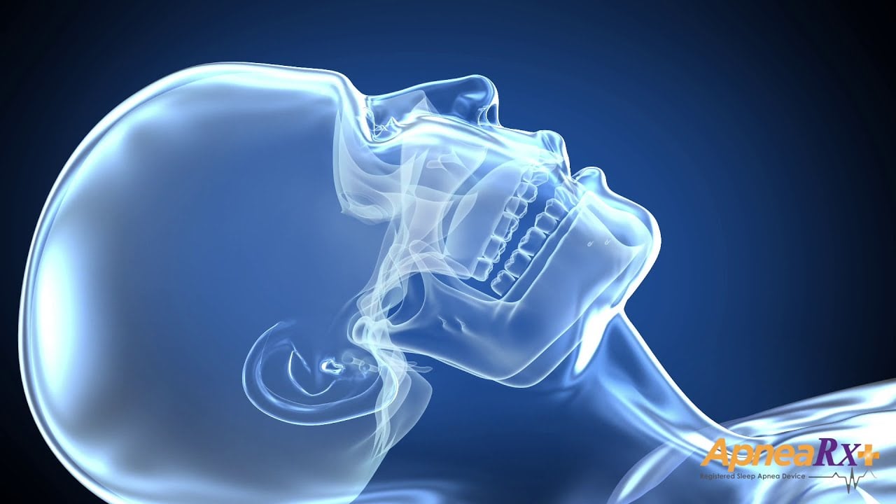 How to stop snoring with ApneaRx
